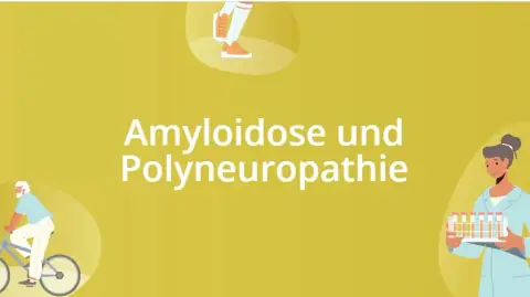 Immagine di anteprima del video «Amiloidosi e Polineuropatia»